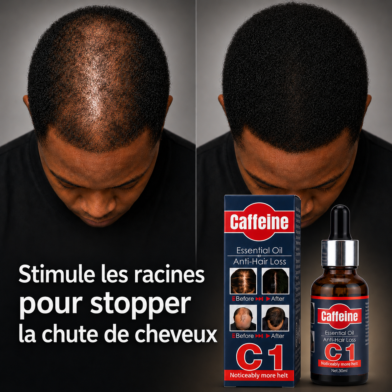 Huile Capillaire Anti-Chute à la Caféine