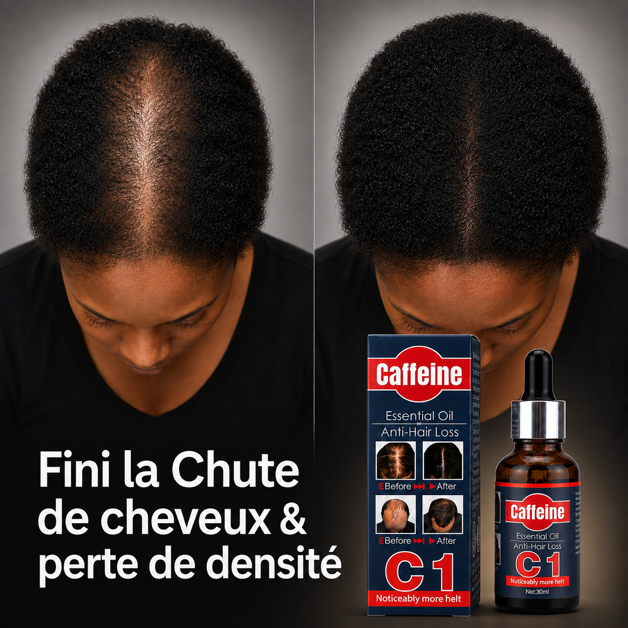 Huile Capillaire Anti-Chute à la Caféine